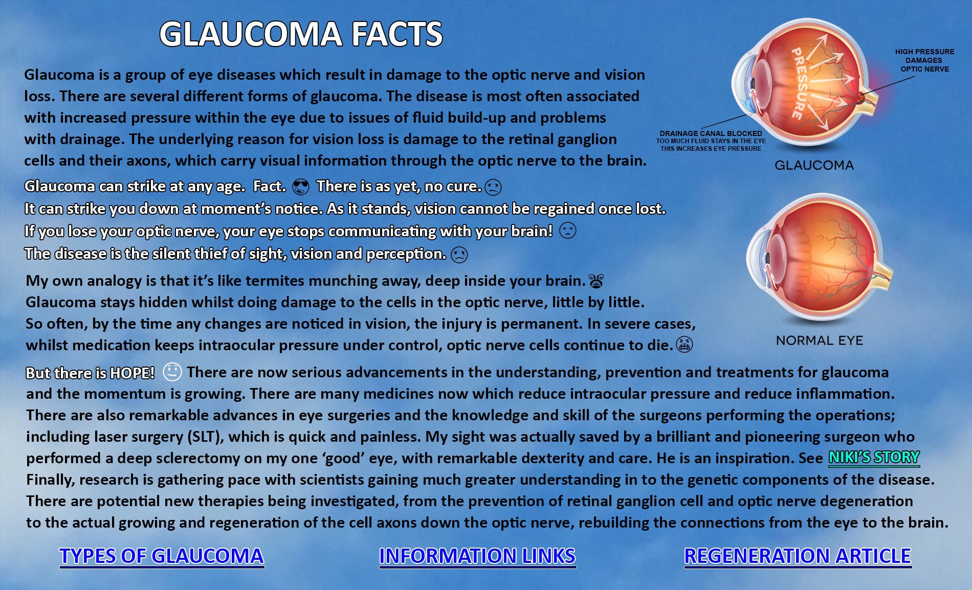 Glaucoma Facts